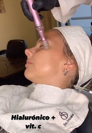 Acido Hialuronico + Vitamina C