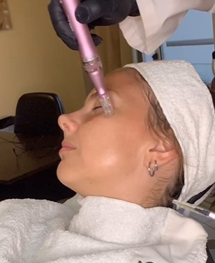 Tratamientos con Hidroxiapatita&nbsp;de&nbsp;calcio